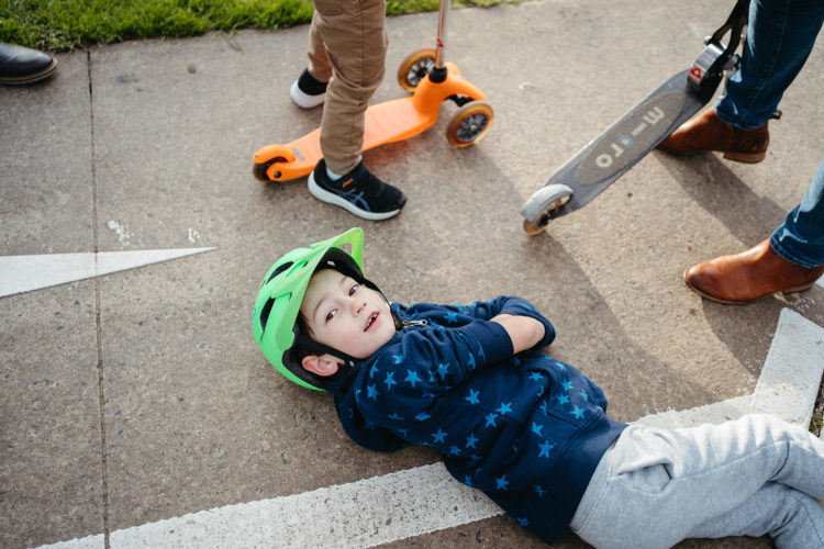 a boy lies on the ground with scooters around him he is having a rest
